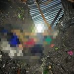 Ket Foto: Korban yang tertimpa longsoran bebatuan di Dusun Cempaka, Desa Pikat, Kecamatan Dawan, Klungkung. Dok (*)