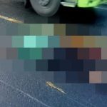 Ket poto: Kondisi korban setelah mengalami kecelakaan tunggal